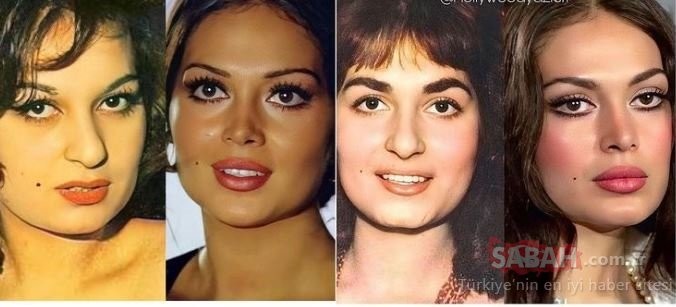 Türkan Şoray yenə estetik əməliyyatı ilə gündəmə gəldi - FOTOLAR