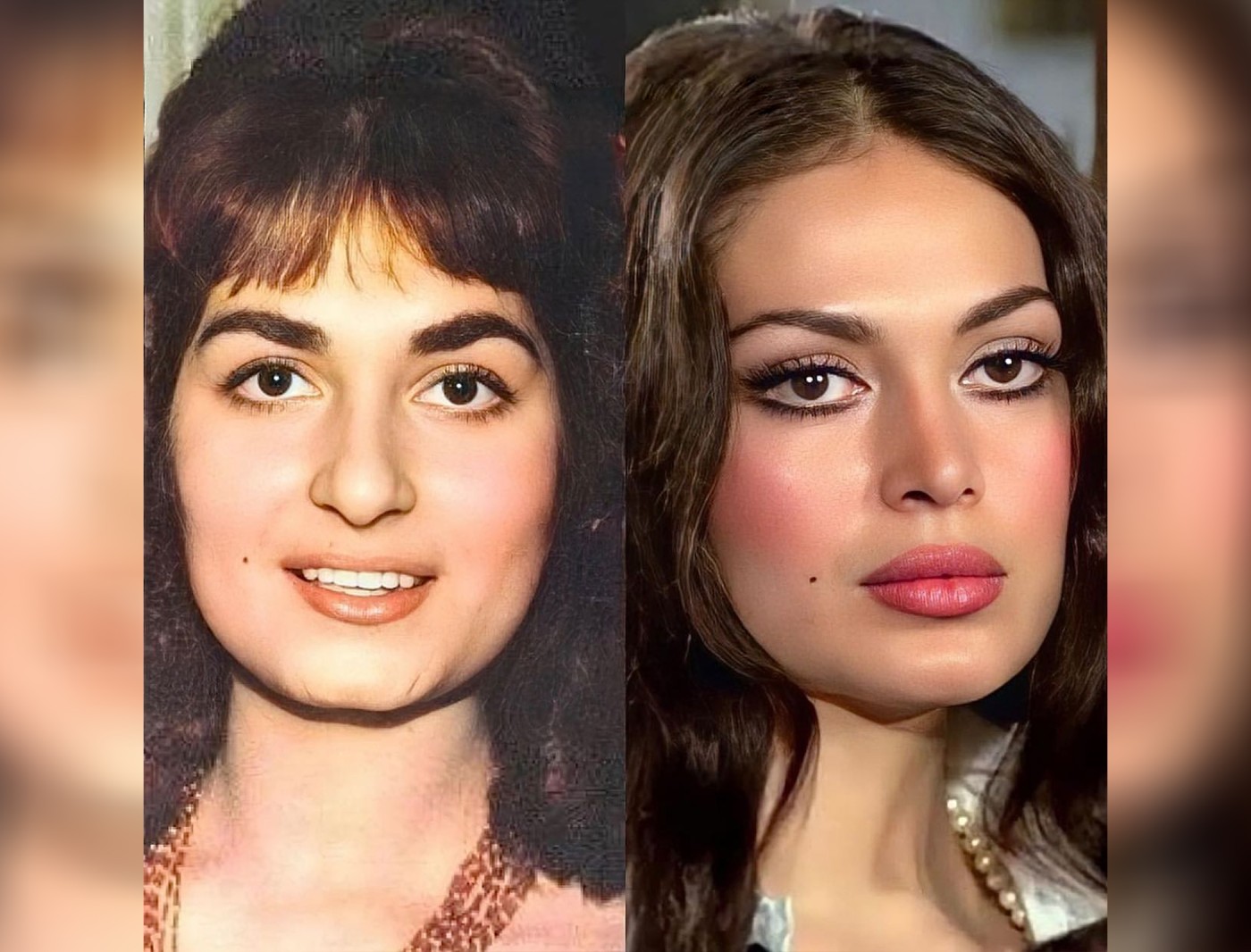 Türkan Şoray yenə estetik əməliyyatı ilə gündəmə gəldi - FOTOLAR