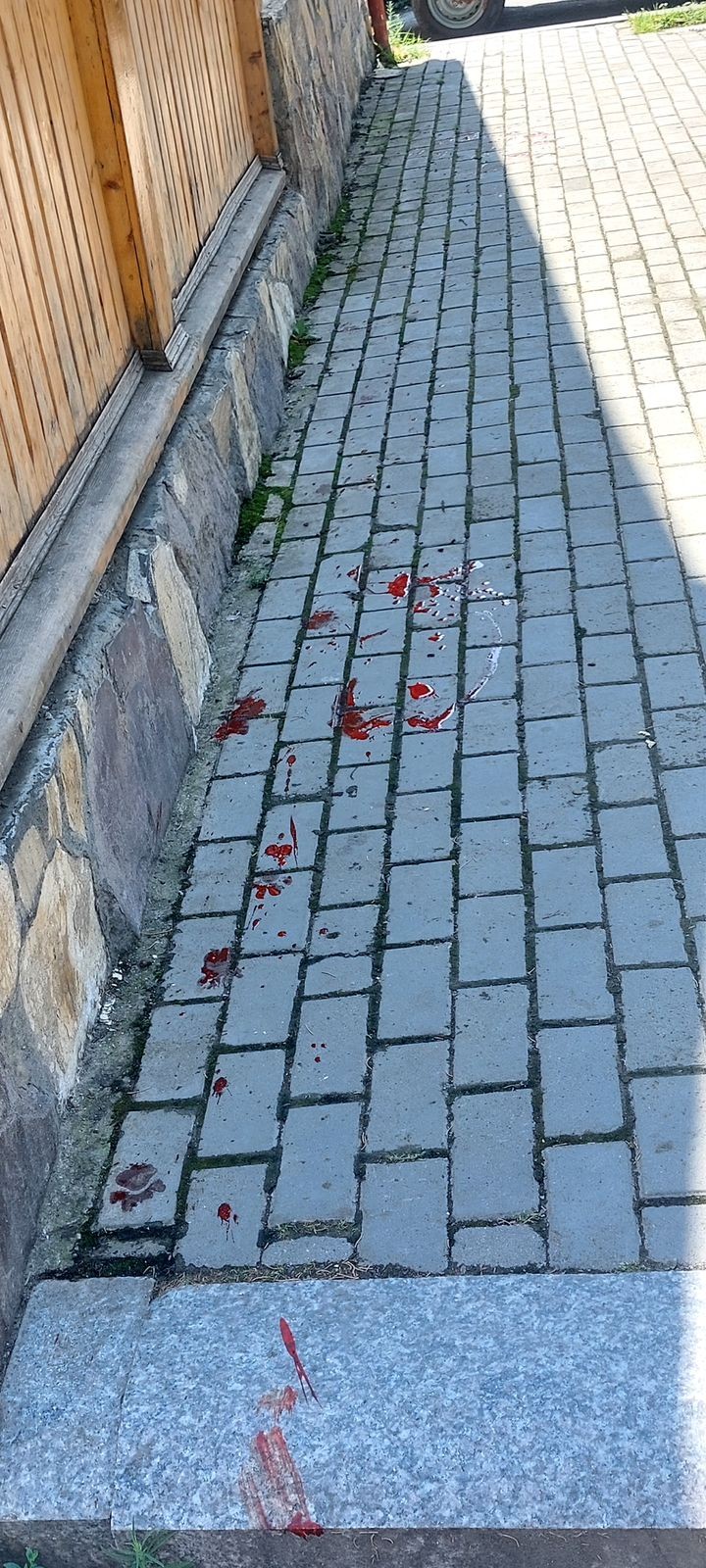 Küçə itinə atəş açan şəxslə bağlı araşdırma aparılır 
