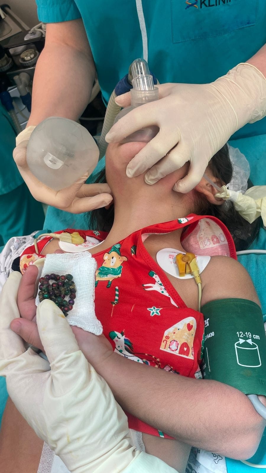Bakıda 4 yaşlı uşaq 53 maqnit udub - FOTO