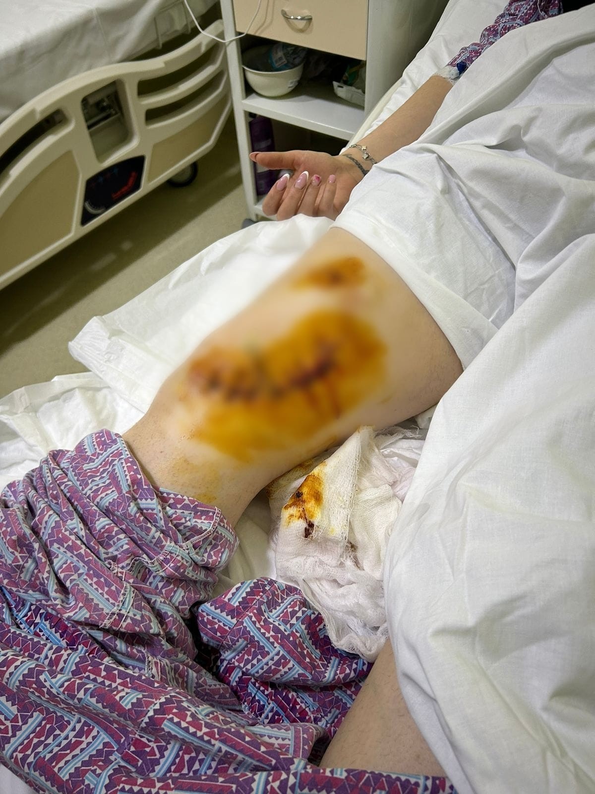 Həyat yoldaşına 5 bıçaq zərbəsi vuran şəxsə cinayət işi açıldı