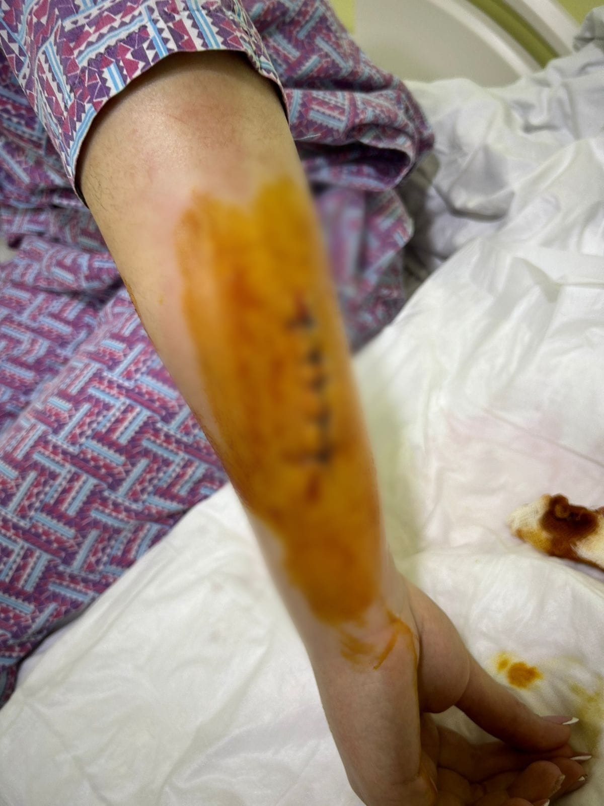 Həyat yoldaşına 5 bıçaq zərbəsi vuran şəxsə cinayət işi açıldı