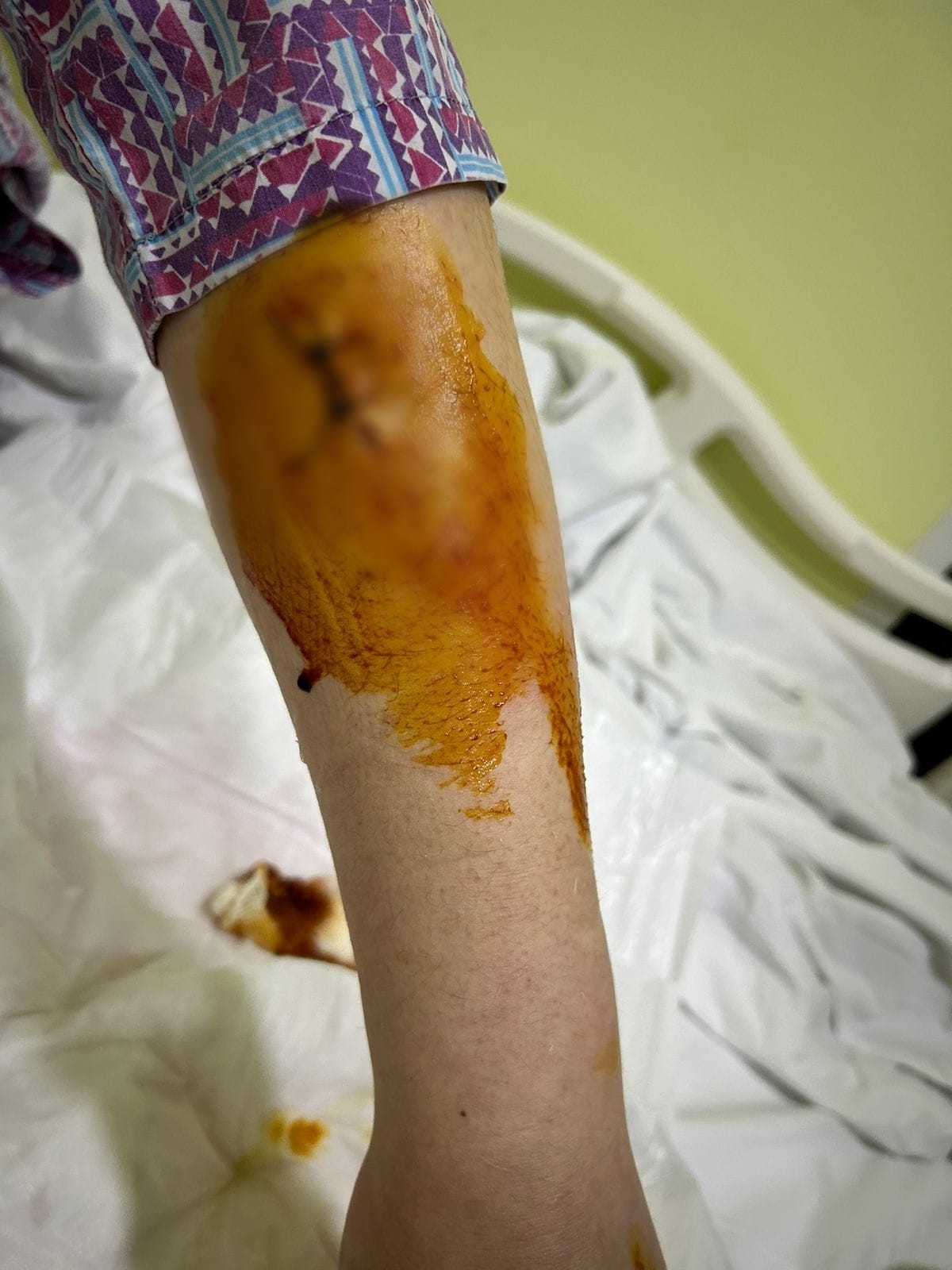 Həyat yoldaşına 5 bıçaq zərbəsi vuran şəxsə cinayət işi açıldı