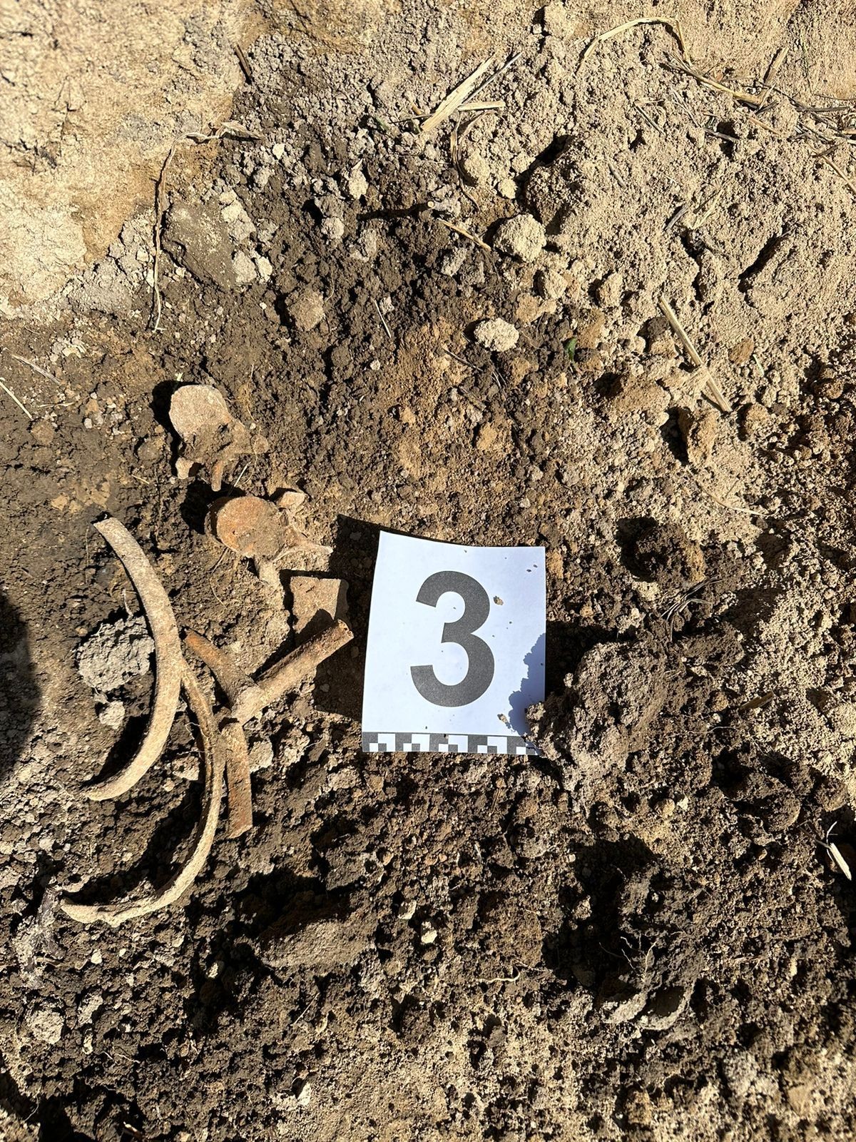 Xocalıda yenə insan qalıqları tapıldı - FOTOLAR