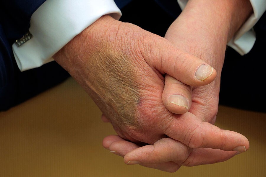 Tramp yenə əlləri ilə diqqət çəkdi - FOTO