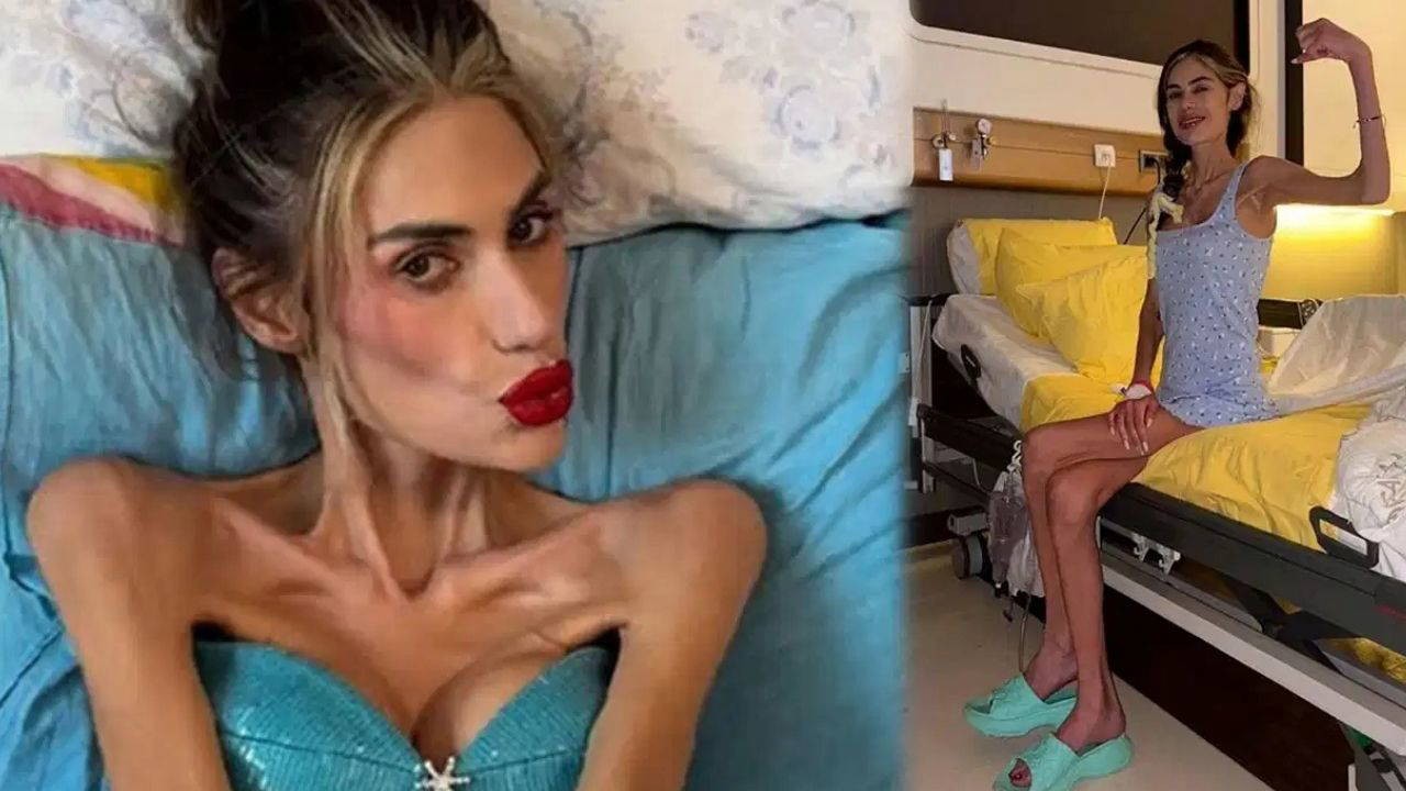 Çəkisi 23 kq-ya düşən Nihal vəfat etdi - FOTOLAR