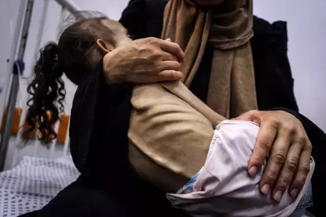 Yaşı 9, çəkisi 10 kq olan qəzzalı qızcığaz - FOTOLAR