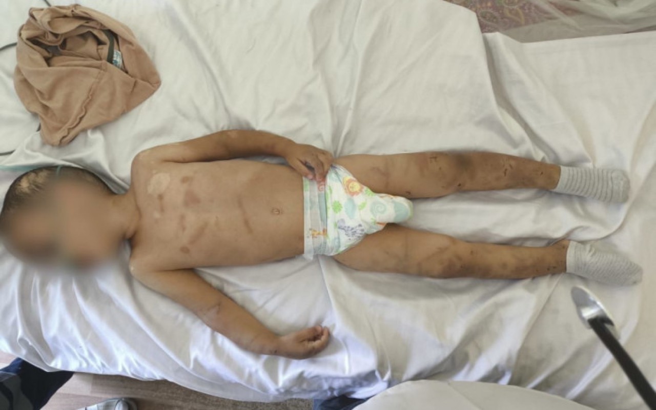 Zorakılığa məruz qalan azyaşlıların valideynlərinin FOTOSU