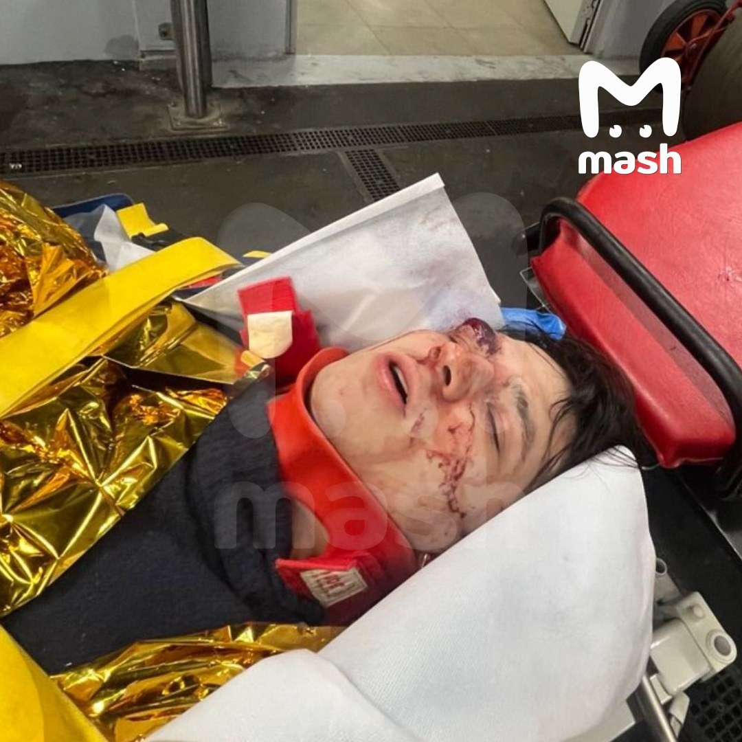 Tanınmış reper Fransada üçüncü mərtəbədən yıxıldı - FOTOLAR (VİDEO)