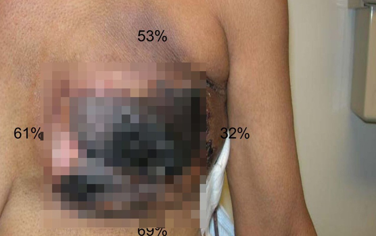 Əməkdar artistin əməliyyatdan sonra bədəni çürüyür? - Vüqar Ələkbərovla bağlı araşdırma başladı (FOTO)