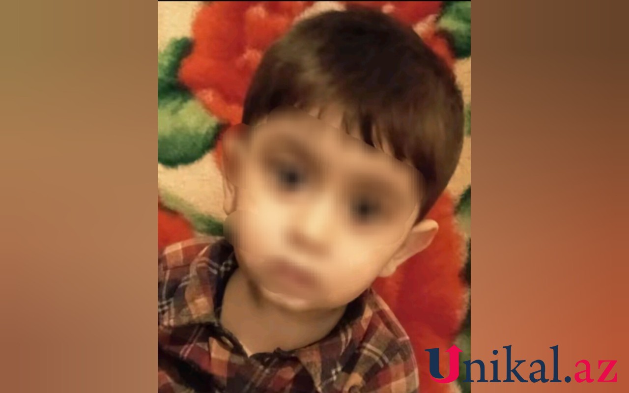 Bu gün 2 yaşı olacaqdı,dünən vəfat etdi