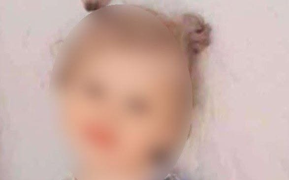 Pişiyin dişlədiyi 4 yaşlı qız öldü