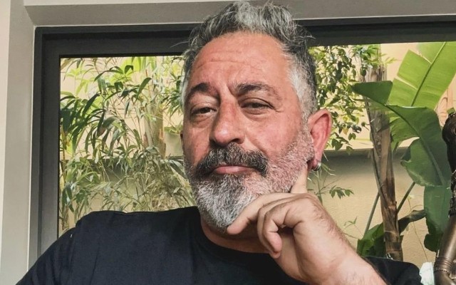 Cem Yılmaz əməliyyatdan sonra - FOTO