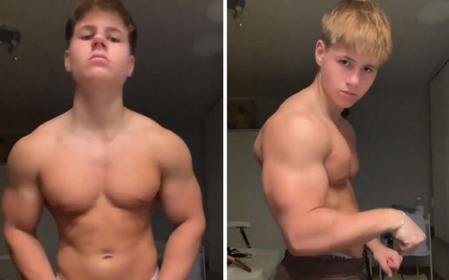 Steroid qəbul edən gəncin son halı gündəm oldu - FOTOLAR
