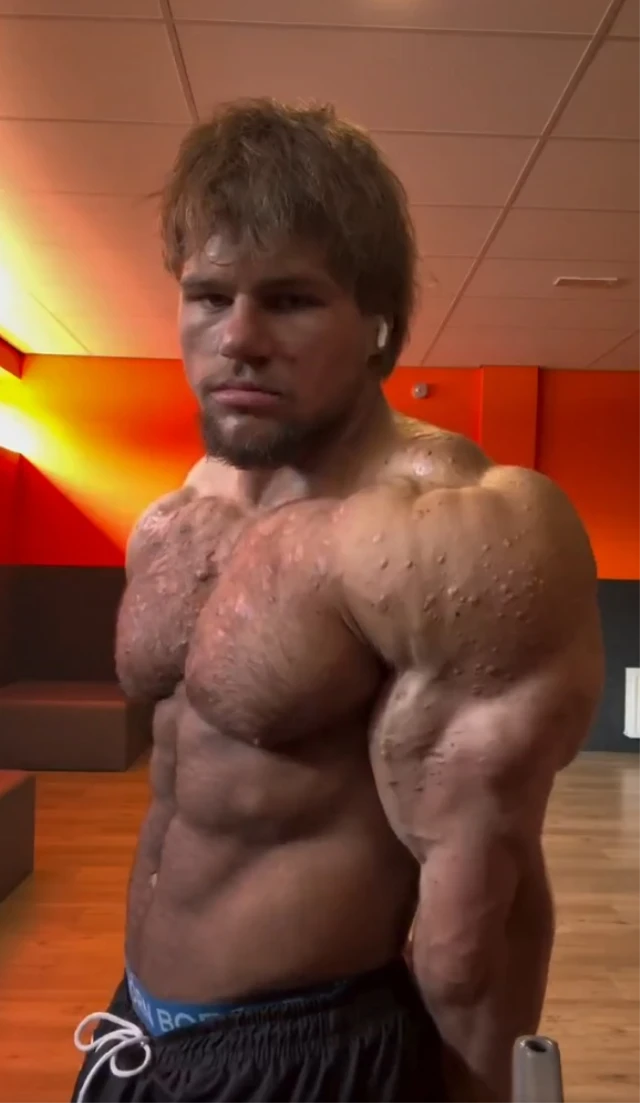 Steroid qəbul edən gəncin son halı gündəm oldu - FOTOLAR