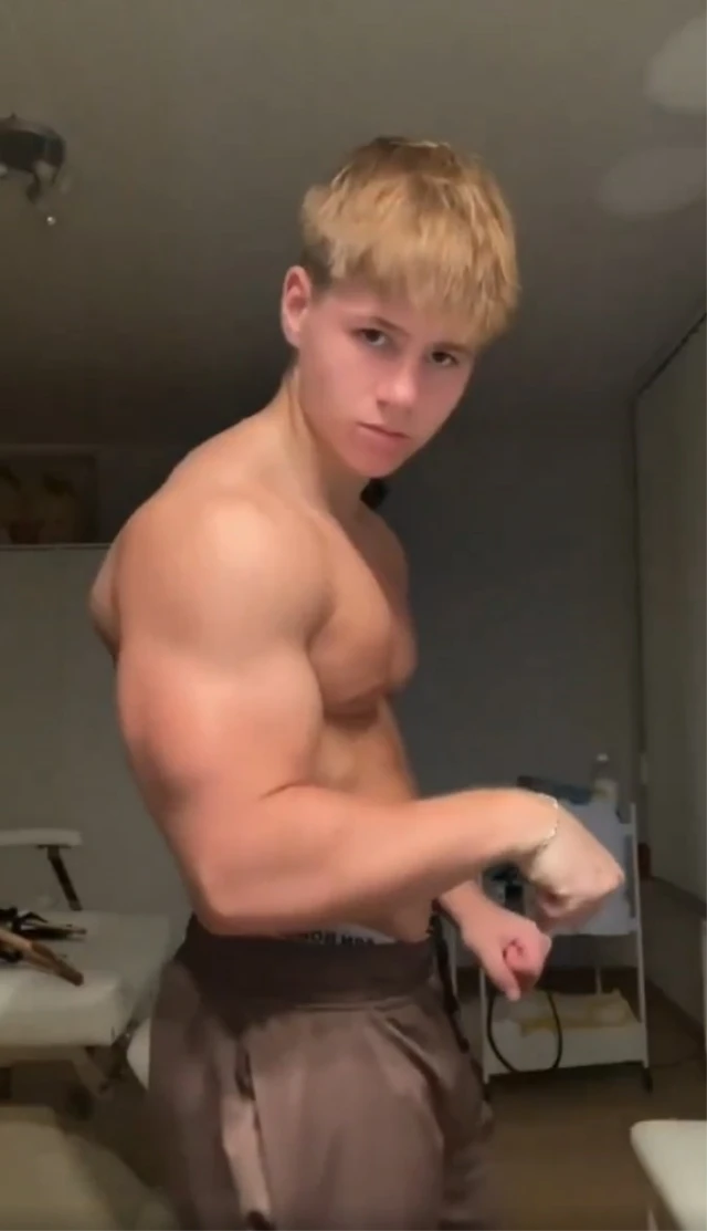 Steroid qəbul edən gəncin son halı gündəm oldu - FOTOLAR