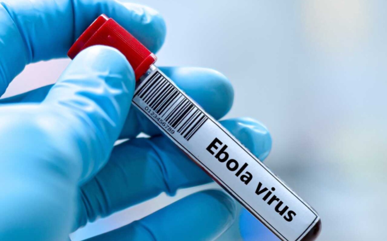Keniyada Ebola virusuna ikinci yoluxma halı qeydə alınıb