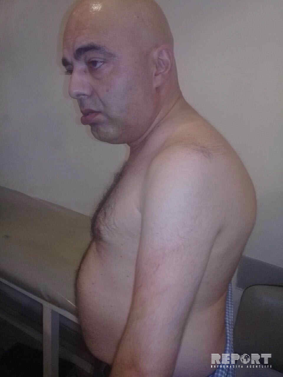 Fiziki qüsurlu şəxs döyülərək bıçaqlandı -   Bakıda (FOTO)