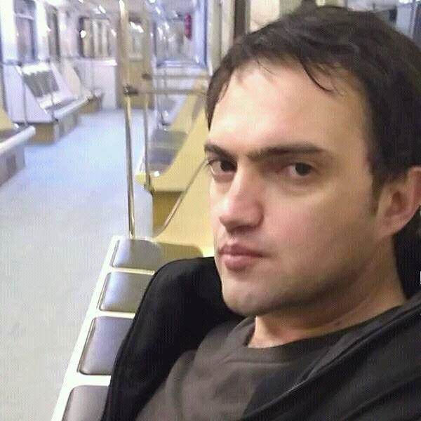 Azərbaycanlı aktyorun çənəsini sındırdılar -   FOTO