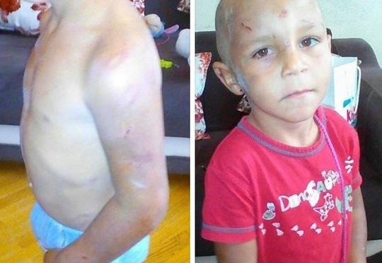 Valideynləri 4 yaşlı uşağı döyüb küçəyə atıblar? - FOTO