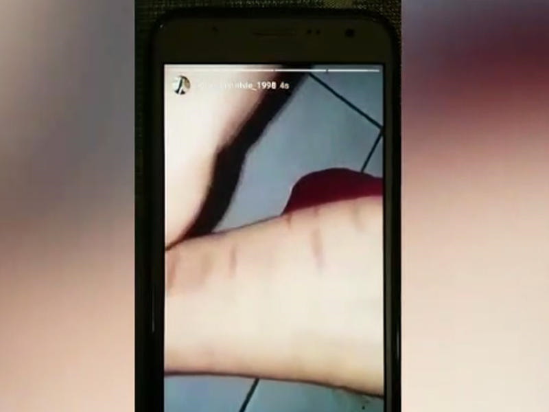 Mingəçevirli cinsi azlıq damarlarını doğradı -   CANLI YAYIMDA (FOTO)