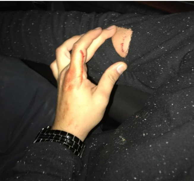 6 it repçi Qurda HÜCUM ETDİ:   Birinin boynunu sındırdıq (FOTO)