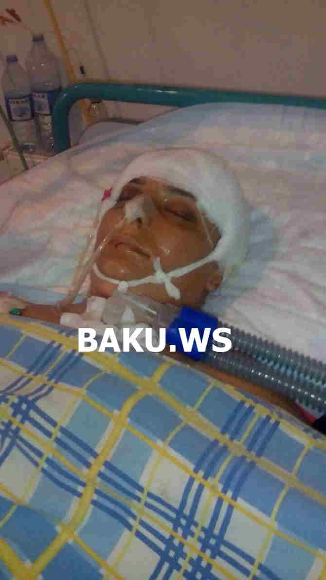 Bakıda yola protiv girən avtobus sürücüsü faciəyə səbəb oldu -    Qadın 18 gündür komadadır (FOTO)