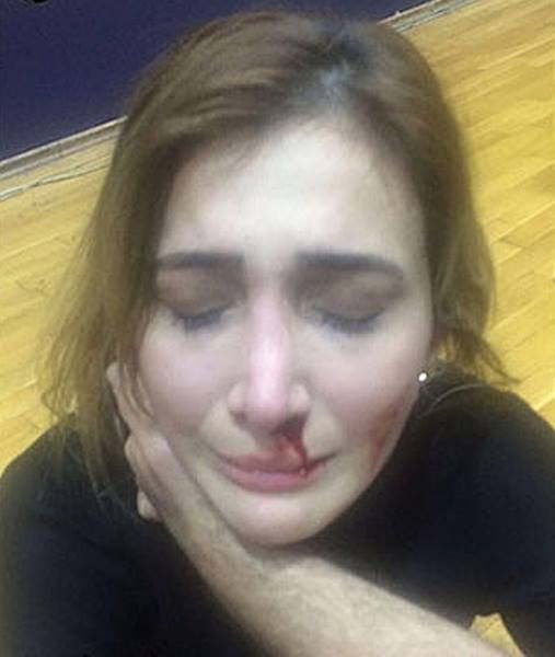 Voleybolçular qadın meneceri döyüb  xəstəxanalıq etdilər