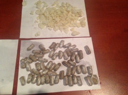 Gömrükdə saxlanılan şəxsin mədəsindən 55 büküm heroin çıxdı  - FOTO