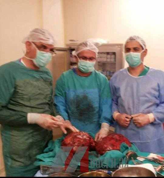 Azərbaycanlı böyrək xəstəsi Ginnesin rekordlar kitabına namizəddir -  VIDEO + FOTO