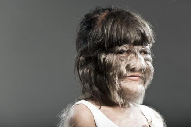 Dünyanın ən tüklü qızını bir də indi görün -  FOTOLAR