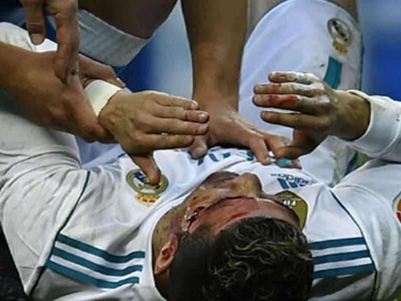 Ronaldo qan içində qaldı   - FOTO