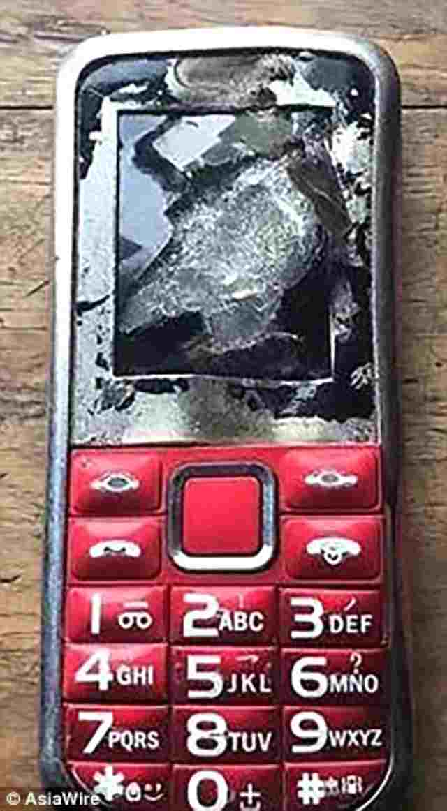  12 yaşlı uşağın əlində telefon partladı  - Bir gözünü və barmağını itirdi (VİDEO)