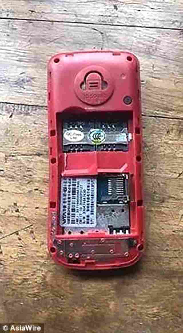  12 yaşlı uşağın əlində telefon partladı  - Bir gözünü və barmağını itirdi (VİDEO)
