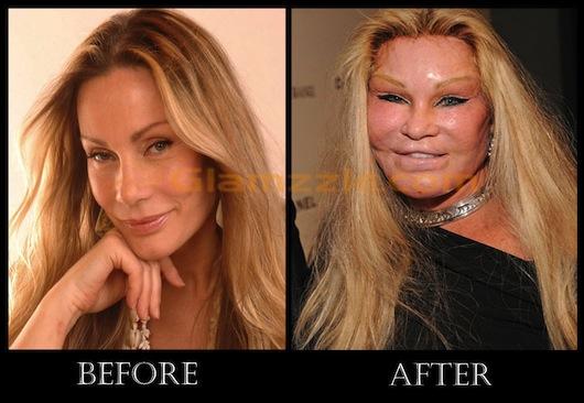 Əri istədi deyə özünü tanınmaz hala saldı -  FOTOLAR