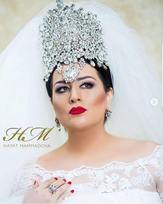 Elza da tac qoydu -  FOTO