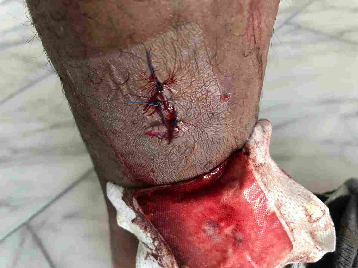  Qovulan futbolçunun yeni klubunda başına iş gəldi  - FOTO 