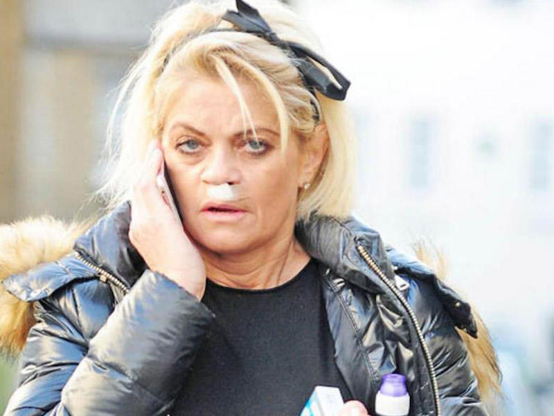 Bütün pulunu əməliyyata qoyan aktrisa bu hala qaldı -  FOTO