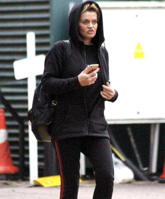 Bütün pulunu əməliyyata qoyan aktrisa bu hala qaldı -  FOTO