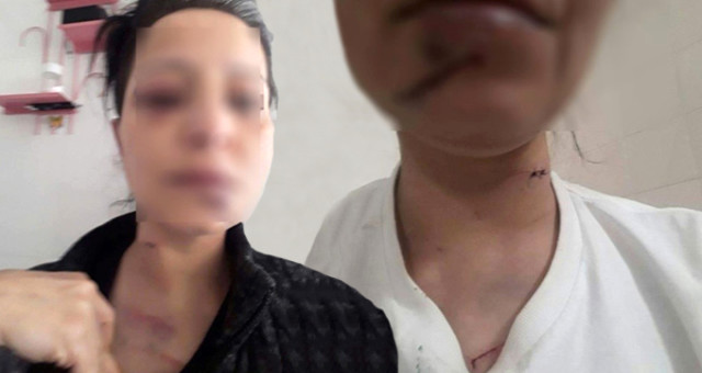 Qadını 2 saat hamamda saxlayıb zorlamaq istədi  - Bədənimdə diş izləri var - FOTO