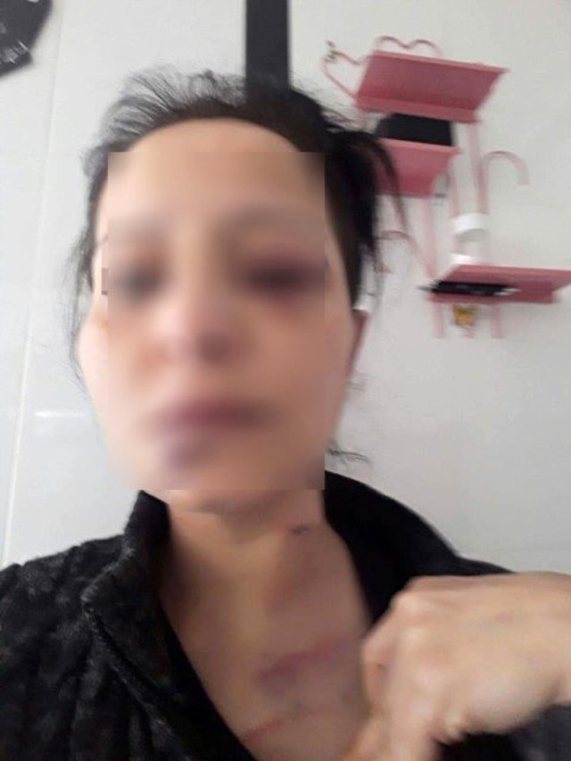 Qadını 2 saat hamamda saxlayıb zorlamaq istədi  - Bədənimdə diş izləri var - FOTO