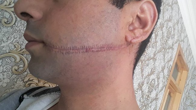 Azərbaycanda 26 yaşlı gəncin ağzını cırdılar   - CİNAYƏT İŞİ AÇILMADI