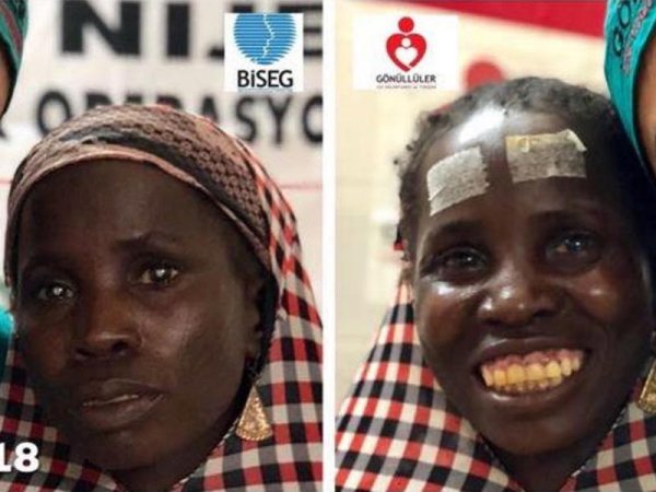 Azərbaycanlı həkim dünyanı ŞOKA SALDI:  anadan kor doğulanı 25 il sonra uğurlu əməliyyat etdi - FOTO
