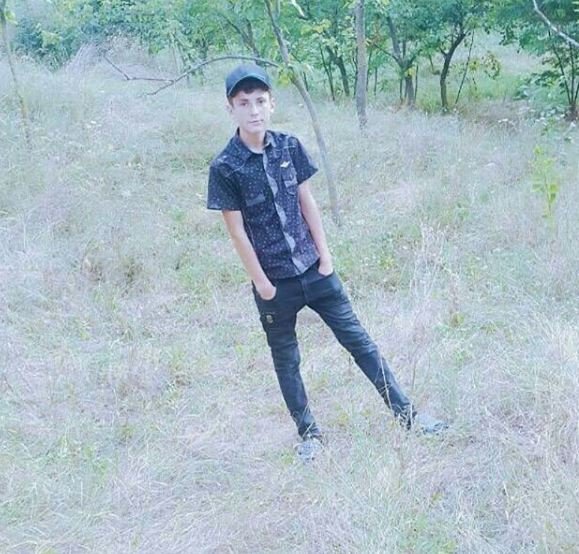 Minaya düşüb, ayağı amputasiya olunan 14 yaşlı Elgünün   FOTOSU