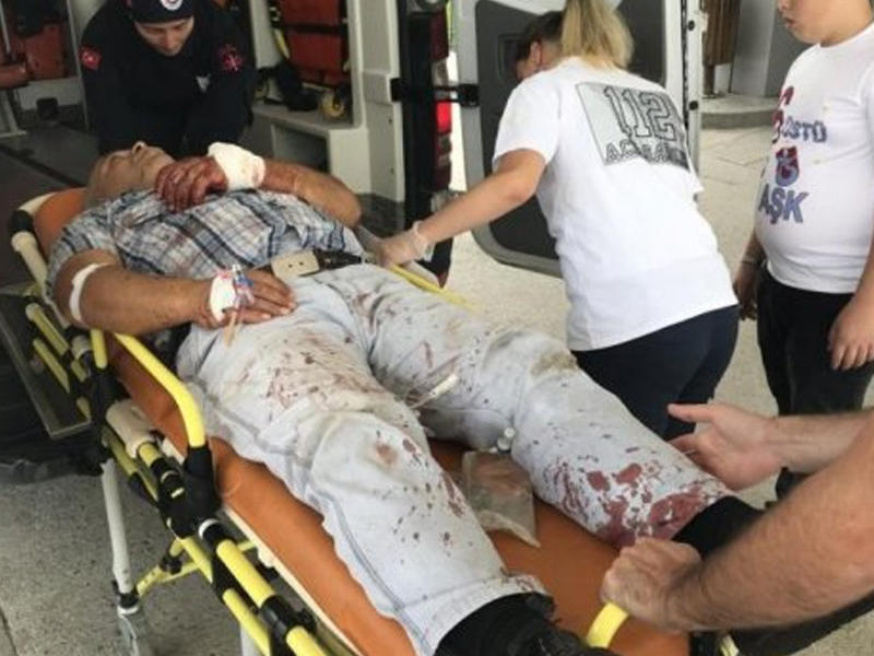 Ölkədə qurban kəsimi:  Yaralı qəssablar xəstəxanalara axın edir - FOTO