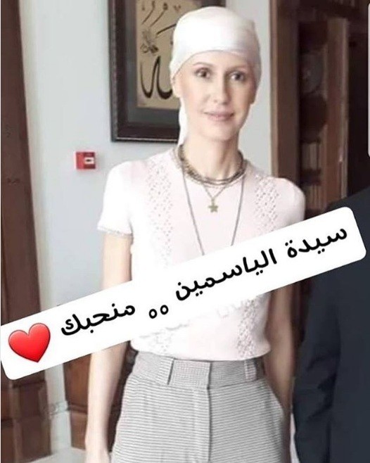 Kimya terapiya müalicəsindən sonra şəklini paylaşdı -   FOTO