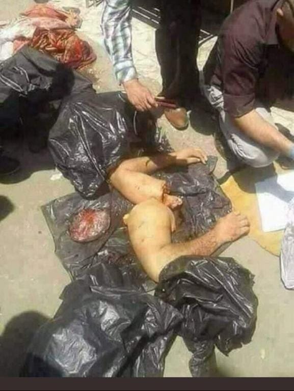Camalın hissələrə bölünmüş cəsədi aşkarlandı:  tikə-tikə doğrayıb,üzünün dərisini soyublar - FOTOLAR