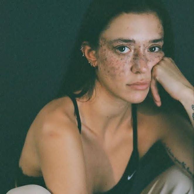 Dünya bu çilli modeldən danışır -  FOTOLAR