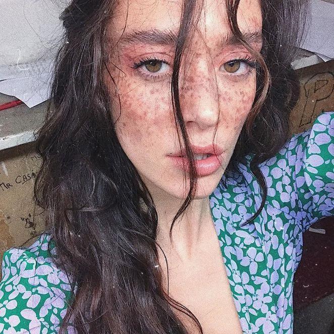 Dünya bu çilli modeldən danışır -  FOTOLAR