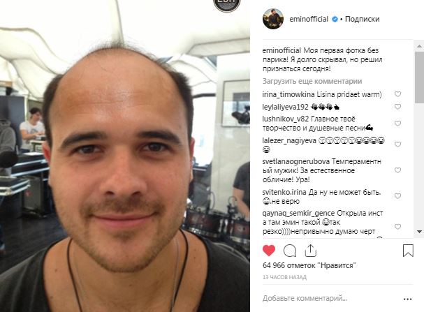 Emin izləyicilərini ŞOKA SALDI -  Pariksiz ilk fotom  